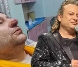 OnurAkay’a saldıran pitbull’un sahibi tutuklandı!