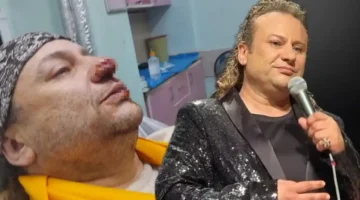 OnurAkay’a saldıran pitbull’un sahibi tutuklandı!